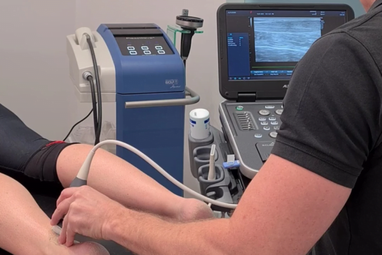 Ultrasound guided shockwave treatment on ankle