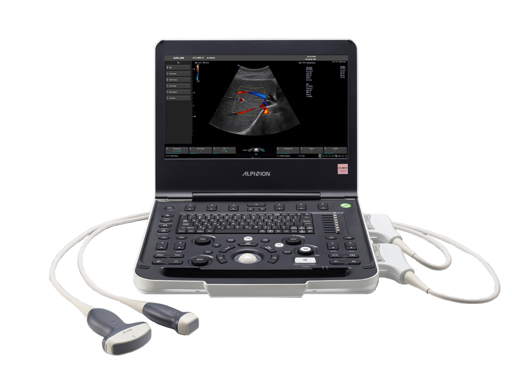 Diagnostic Ultrasound Trade-In: Upgrade to Alpinion